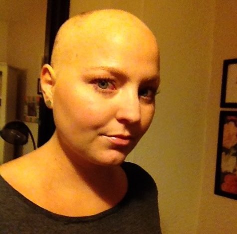 chemo5